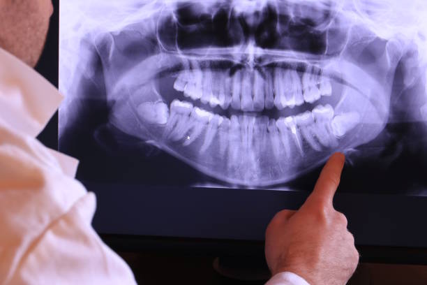 Best Emergency Wisdom Teeth Removal in Siesta Acres, TX